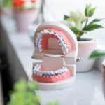 traitements orthodonties