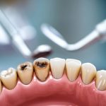 Les signaux d’alerte qui doivent vous pousser à consulter rapidement un dentiste