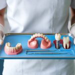 Les différentes options de prothèses dentaires pour remplacer des dents manquantes