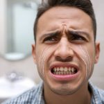 Focus sur la fluorose : causes, conséquences et traitements