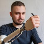 Prothèses amovibles ou fixes : quelle solution est la plus adaptée à votre mode de vie ?
