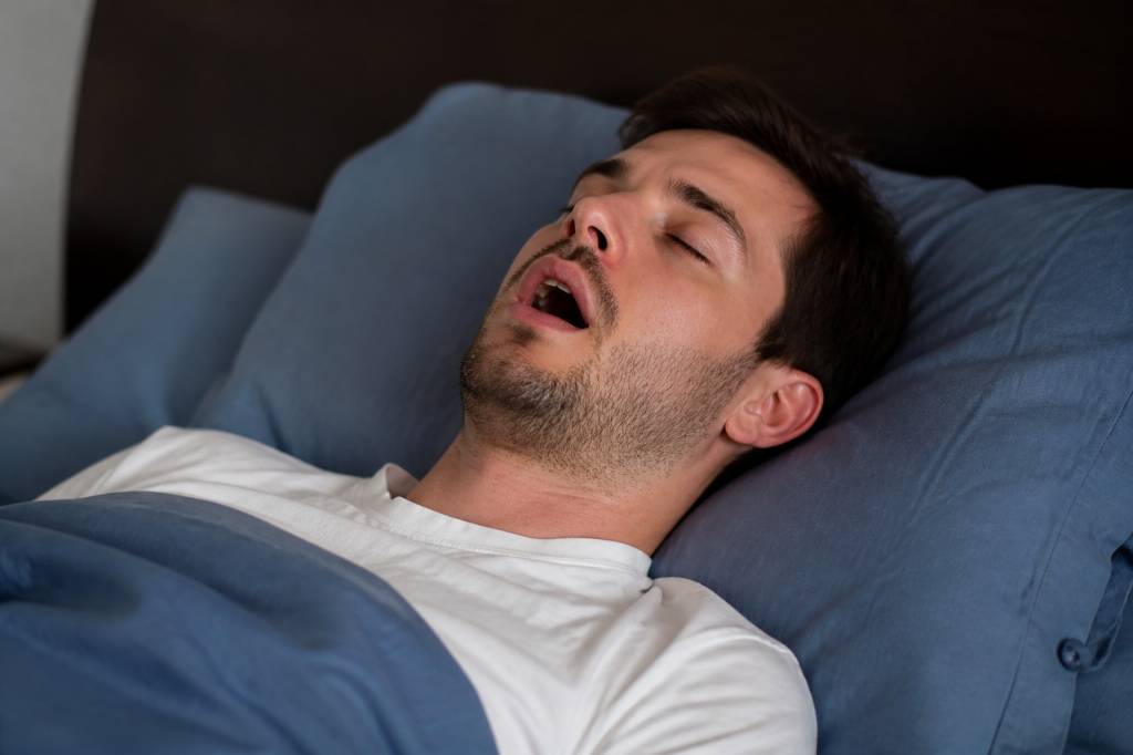 Les conséquences du sommeil en apnée sur la santé bucco-dentaire et les solutions à envisager